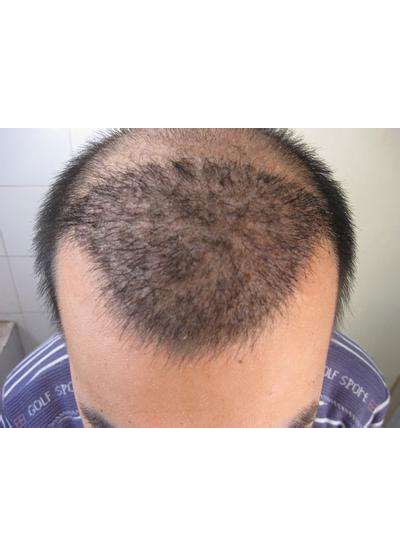 焦作植发是郜氏开办的吗