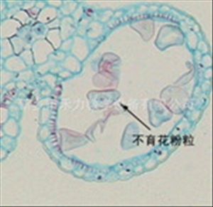 病理学大体标本