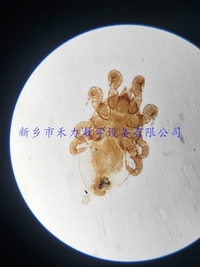 人体寄生虫  革螨装片