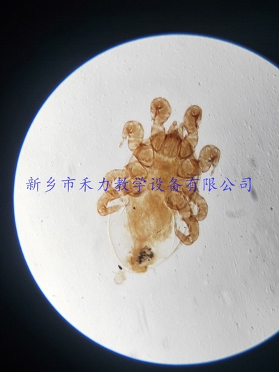 人体寄生虫  革螨装片