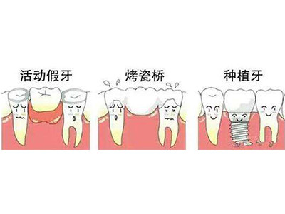 成人牙齿修复专科