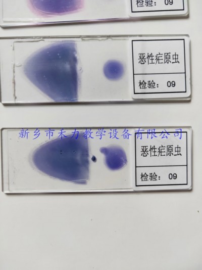 恶性疟原虫  间日疟原虫  三日疟原虫  人体寄生虫病标本