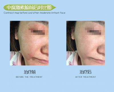 患者案例