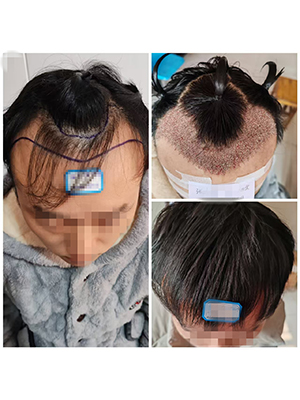 种头发，选卫辉郜氏