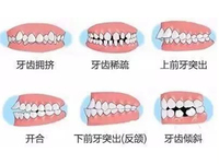 成人牙齿正畸专科