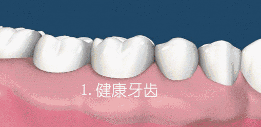 03.gif